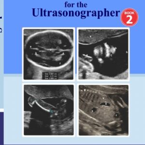 Anomaly Scan for the Sonographer  Book 2