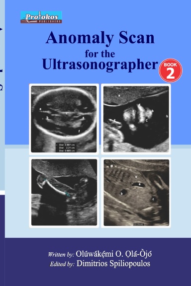 Anomaly Scan for the Sonographer Book 2