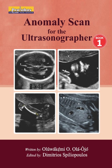 Anomaly Scan for the Sonographer Book 1