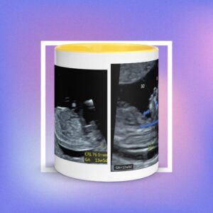 NT Screening Specialist Mug | FAVOUR