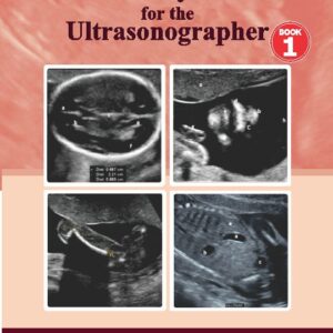 Anomaly Scan for the Ultrasonographer – Book 1