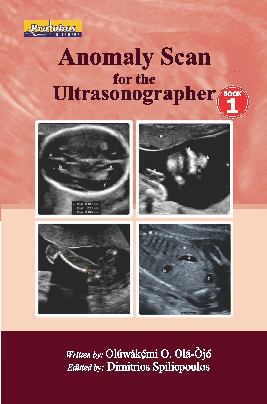 Anomaly Scan for the Ultrasonographer – Book 1