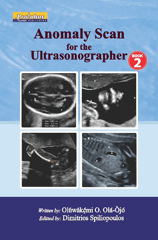 Anomaly Scan for the Ultrasonographer – Book 2
